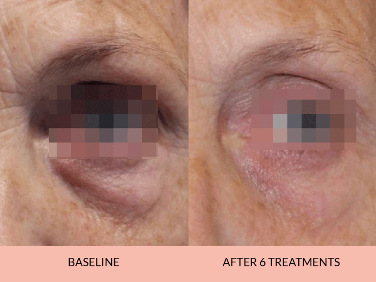 Before_after-02_-768x575-1