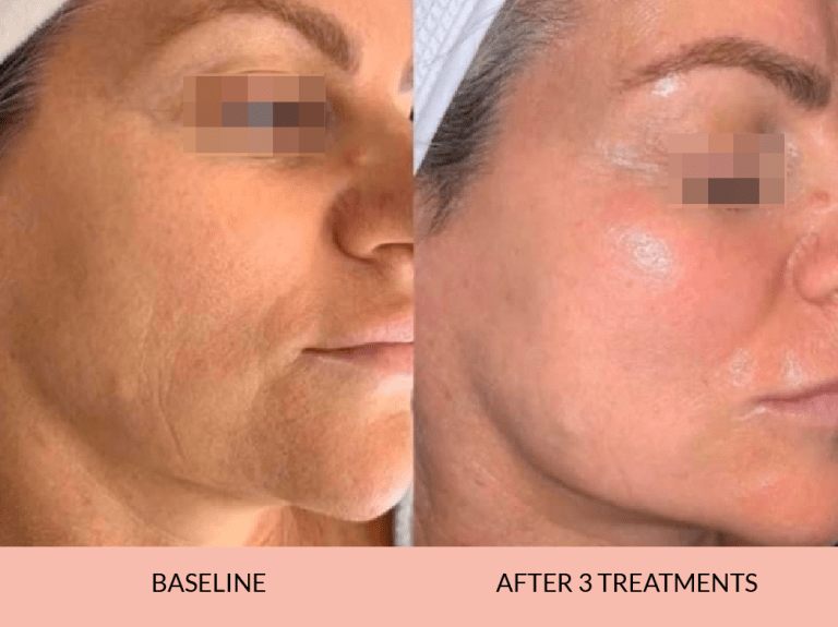 Before_after-12_-768x575-1