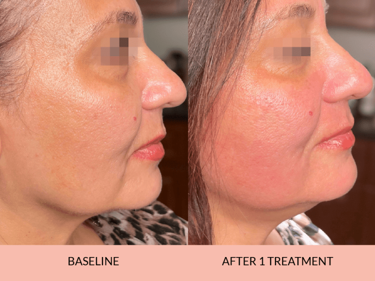 Before_after-13_-768x575-1