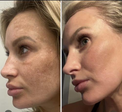 4WiqNkA8gG9_XoFCU4bp7P4nSOWdD7gK7w