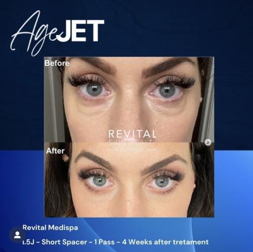 yk_dea8Xfunn_UA0nPeQd4KlkI-a0PQETg